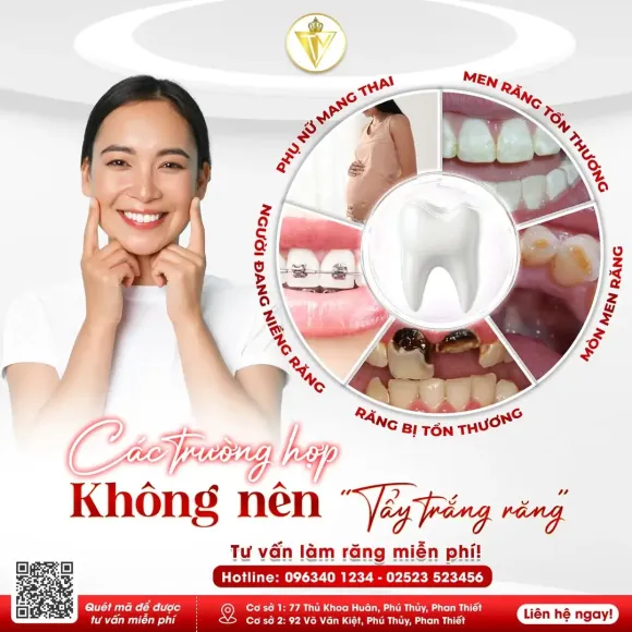  CÁC TRƯỜNG HỢP KHÔNG NÊN TẨY TRẮNG RĂNG 