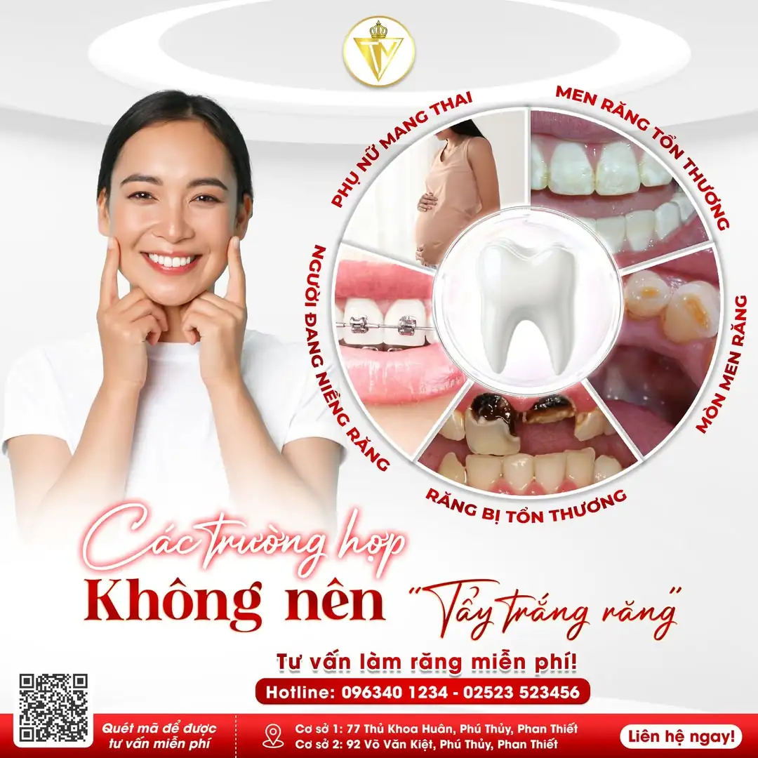  CÁC TRƯỜNG HỢP KHÔNG NÊN TẨY TRẮNG RĂNG 