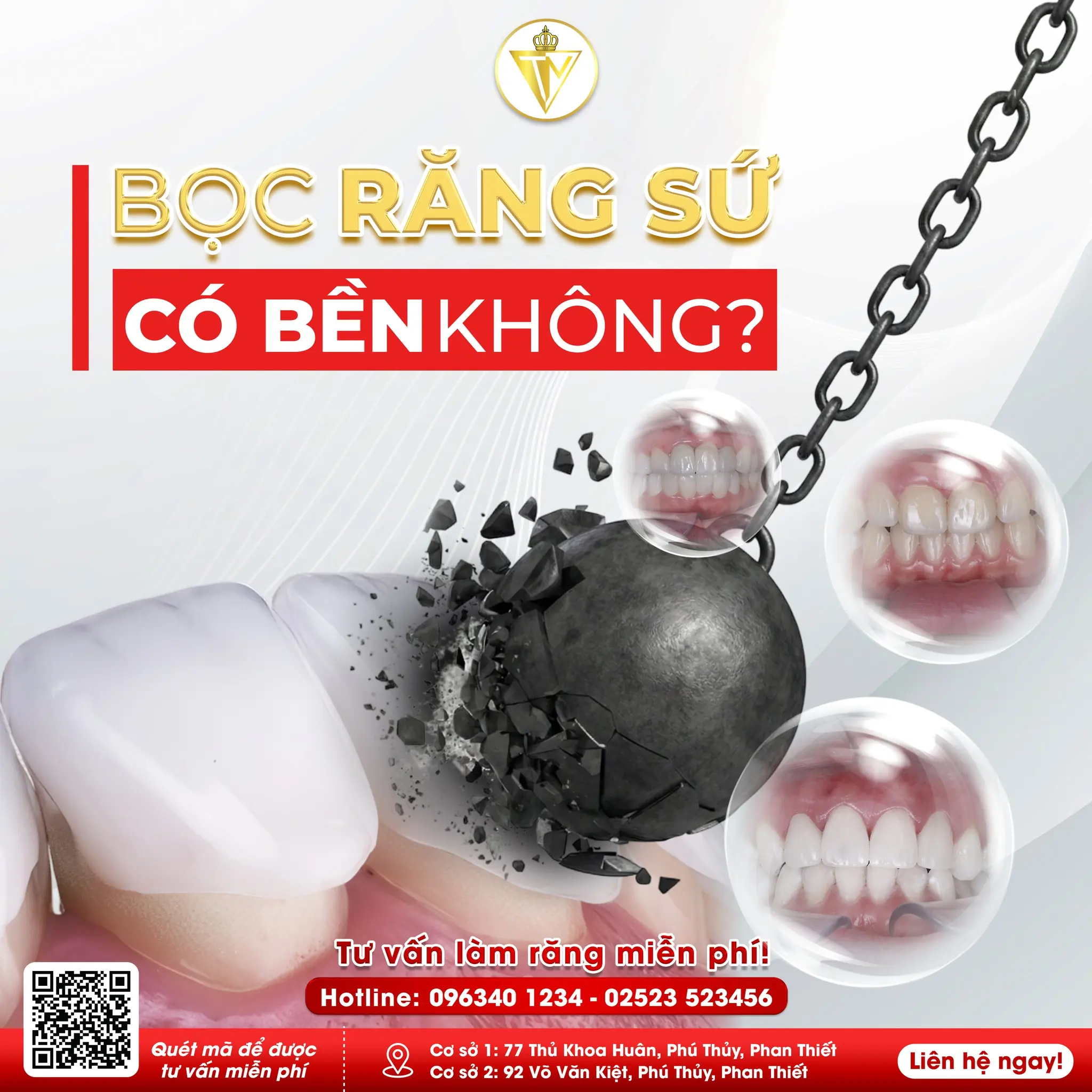 Bọc Răng Sứ Có Ăn Được Đồ Cứng Không?