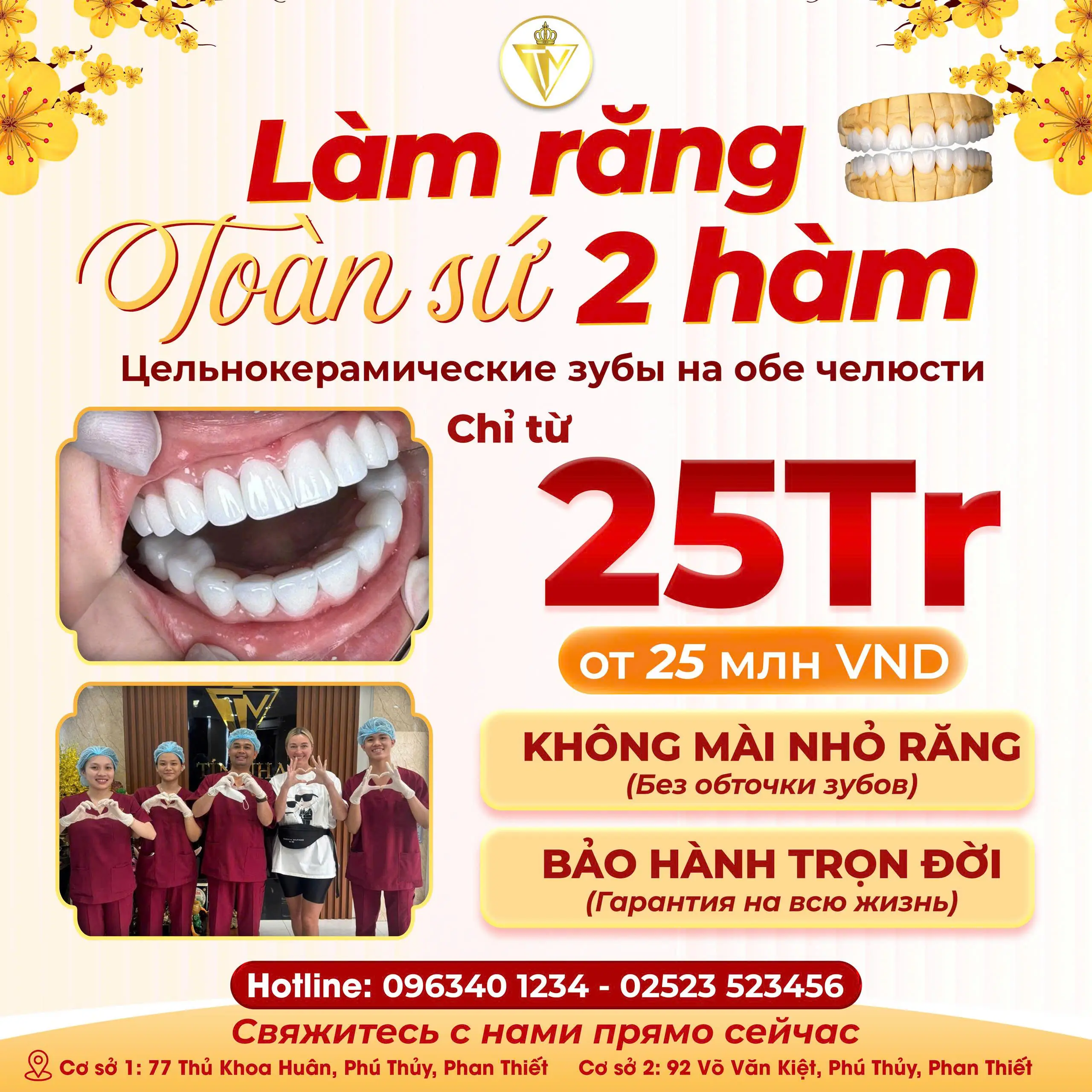LÀM RĂNG SỨ 2 HÀM